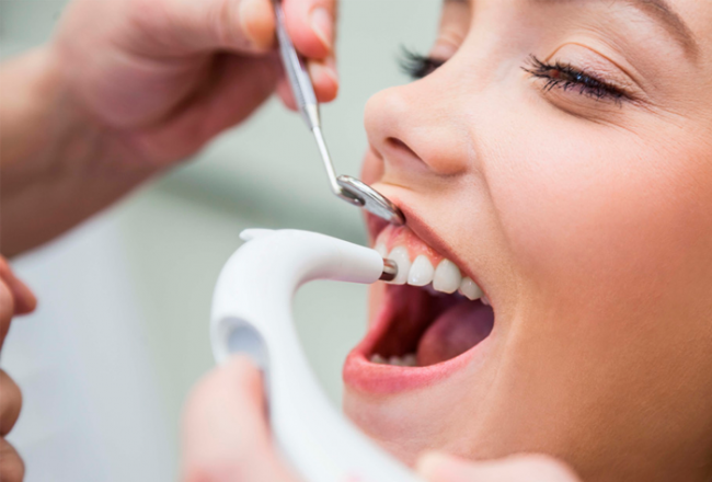 Профессиональная чистка зубов — отзывы