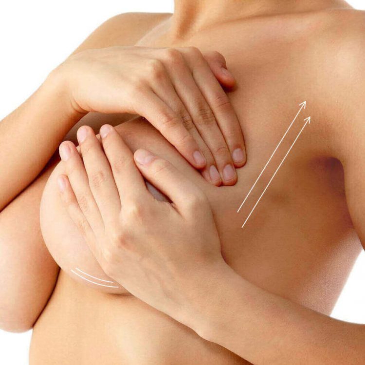 Мастопексия (подтяжка) груди — отзывы