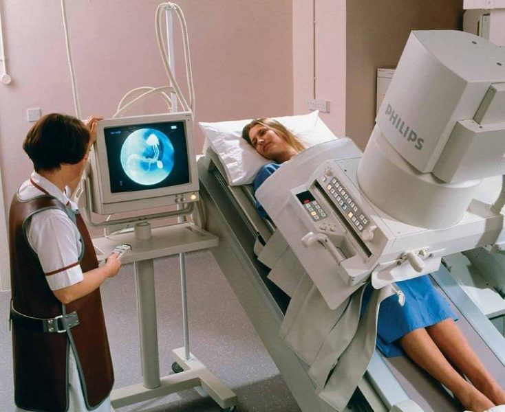 Ирригоскопия (рентген кишечника) — отзывы